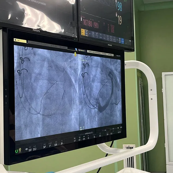 В Университетской клинике провели серию уникальных операций на сердце - фото 5