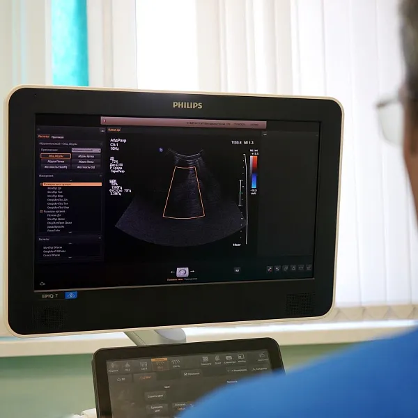 УЗИ - фото 4